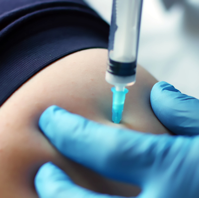Intramuscular (IM) Injections
